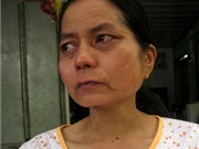 Bóng đá anh, ngoại hạng anh, lịch thi đấu euro 2012, Cô gái trẻ mang gương mặt bà lão sẽ sang Đài Loan chữa bệnh